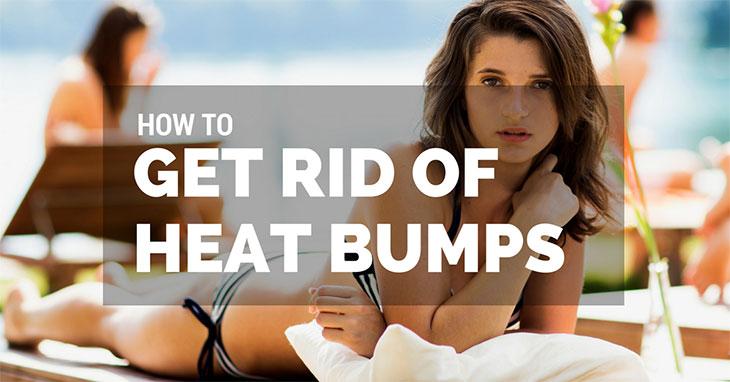 How to Get Rid of Heat Bumps