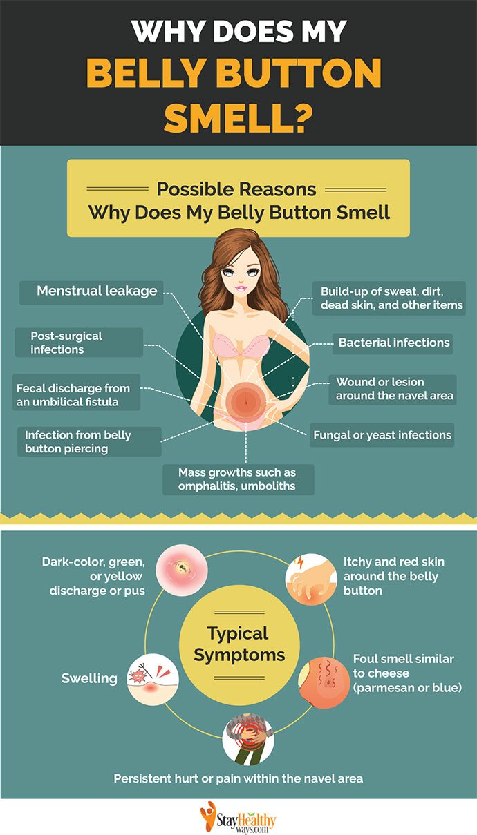 why does my belly button smell infographic