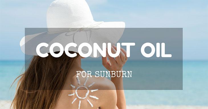 coconut oil for sunburn