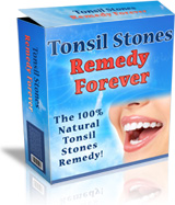 Tonsil Stones Remedy Forever